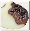 Фузариоз